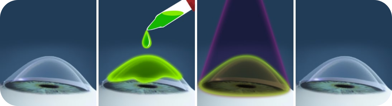 Proceso de evaluación